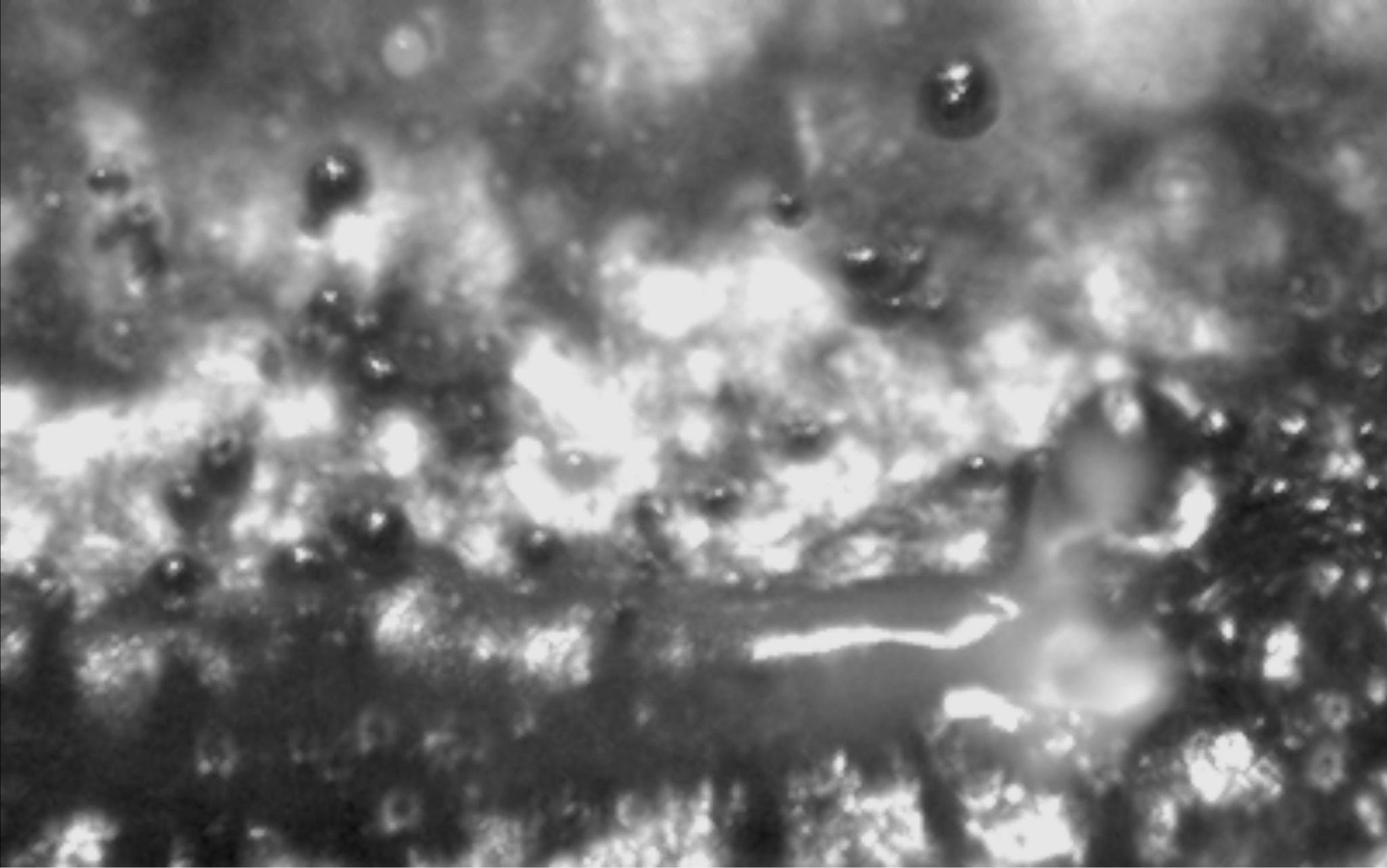 Origins of Melt Ejection and Spatter in Laser Powder Bed Fusion